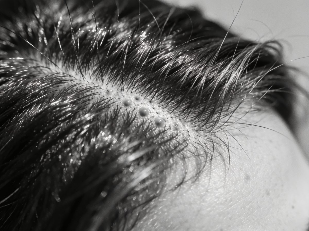 Macro da risca do cabelo com fios recuperando espessura